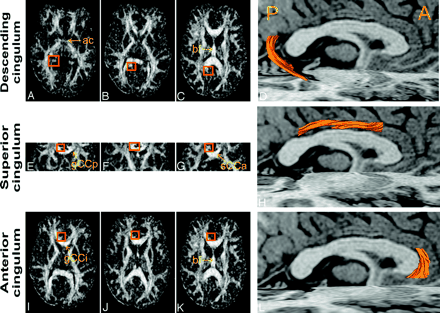 Fig 3.