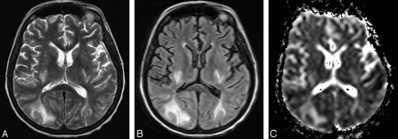 Fig 3.