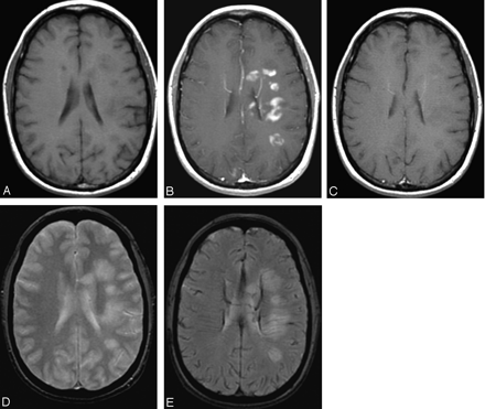 Fig 1.