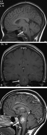 Fig 6.