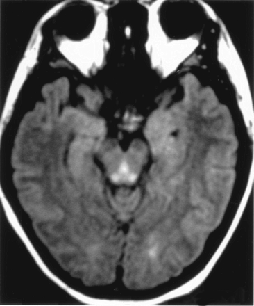 Fig 1.