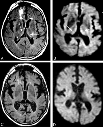 Fig 2.