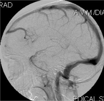 Fig 5.