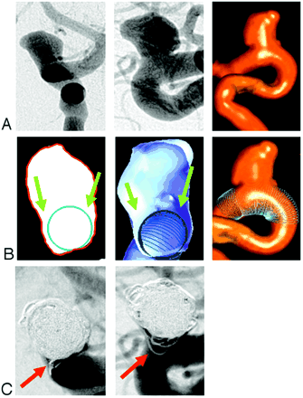 Fig 1.
