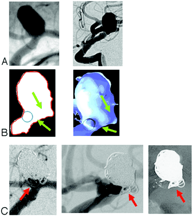 Fig 2.