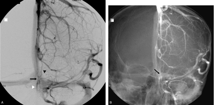Fig 2.