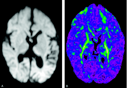 Fig 3.
