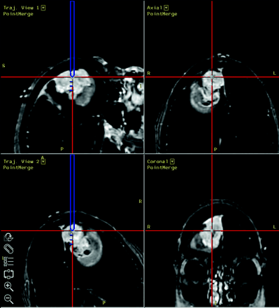 Fig 2.