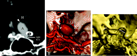 Fig 6.