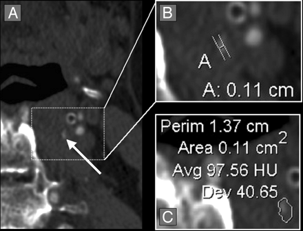 Fig 4.
