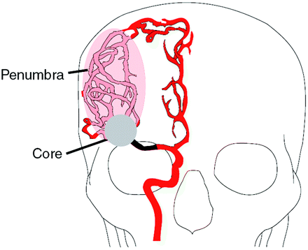 Fig 2.
