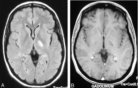 Fig 4.