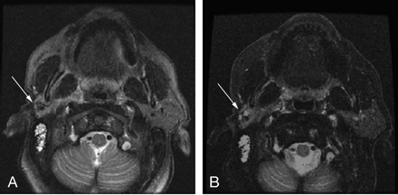 Fig 1.