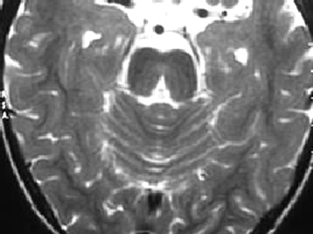 Fig 2.