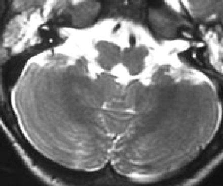 Fig 3.