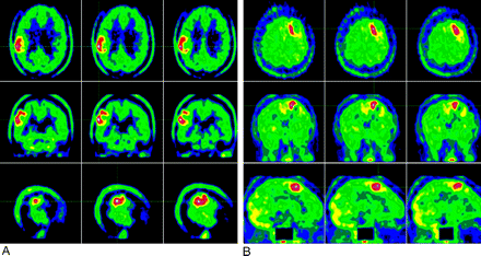 Fig 3.