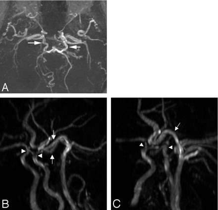 Fig 2.