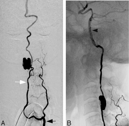 Fig 6.