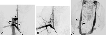 Fig 2.