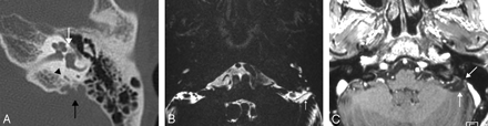 Fig 2.