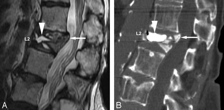 Fig 2.