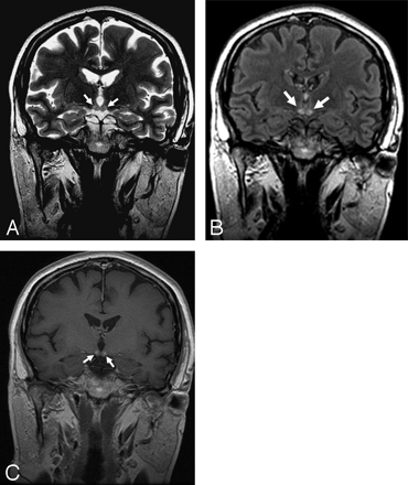 Fig 2.