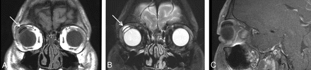 Fig 1.