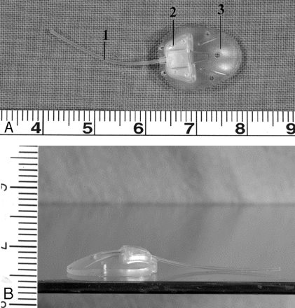 Fig 2.