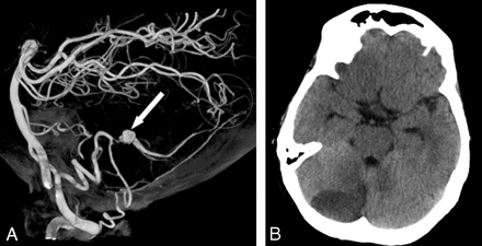 Fig 4.