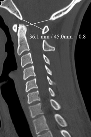 Fig 3.