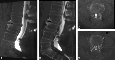 Fig 3.