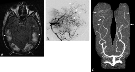 Fig 2.