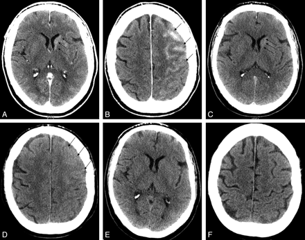 Fig 2.