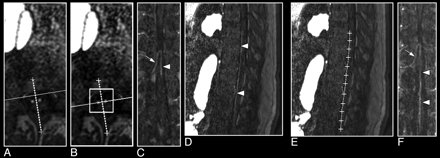 Fig 6.