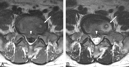 Fig 1.