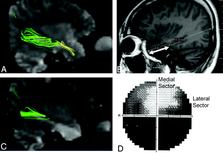 Fig 3.