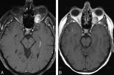   Fig 1. 