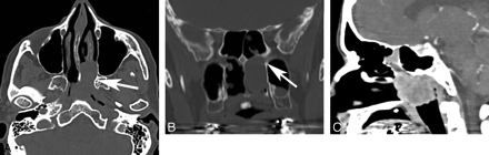 Fig 2.