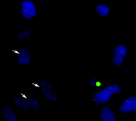 Fig 3.