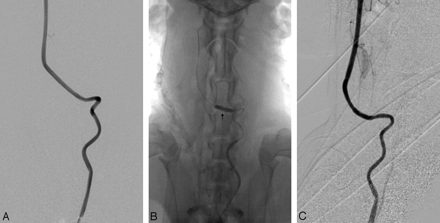 Fig 3.