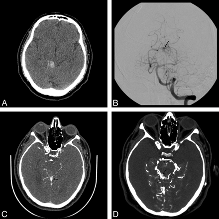 Fig 3.