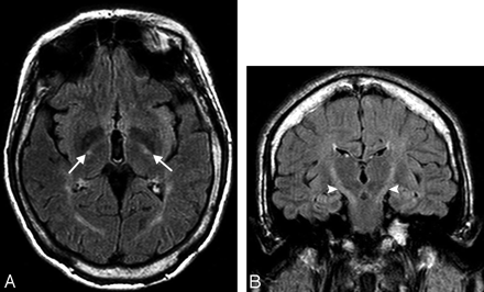 Fig 2.