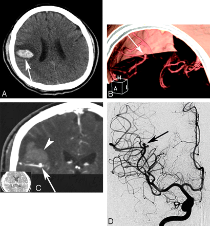 Fig 1.
