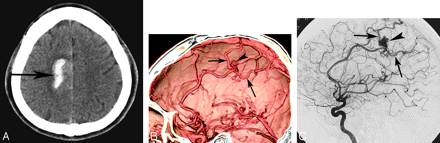 Fig 2.