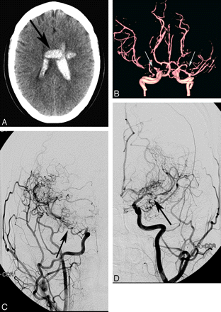 Fig 3.