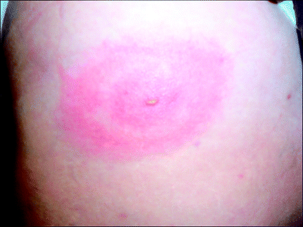 Fig 3.