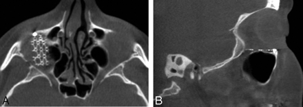 Fig 6.