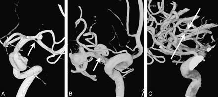 Fig 4.