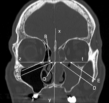 Fig 2.