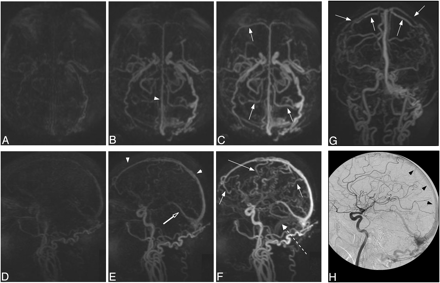 Fig 2.